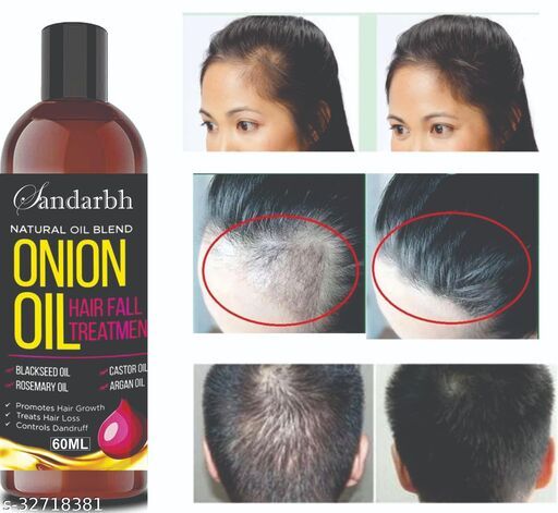 Sandarbh Onion Oil for Hair Regrowth & Hair Fall Control Hair Oil